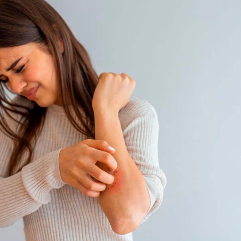 Jabón natural de laurel, ayuda a calmar el picor