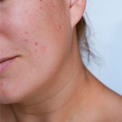 Jabón natural de papaya, suave exfoliación facial